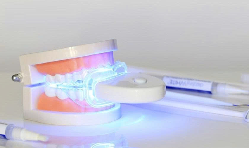 Gói Tẩy Trắng Răng Laser Whitening