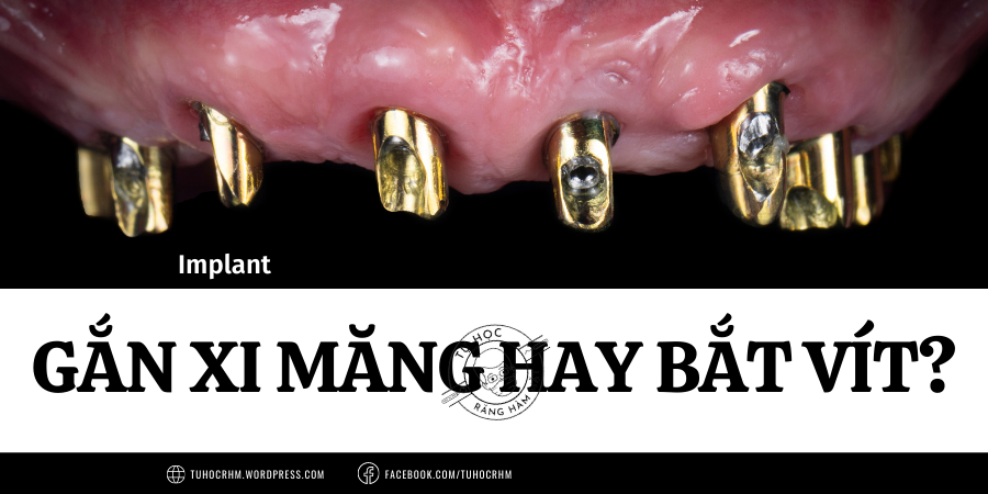 Implant Gắn Xi Măng hay Bắt Vít? Ưu Nhược Điểm & Cách Lựa Chọn
