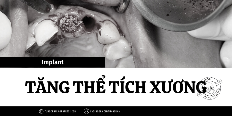 Tăng Thể Tích Xương (GBR) Trong Cấy Ghép Implant: Nguyên Tắc & Quy Trình (2026)