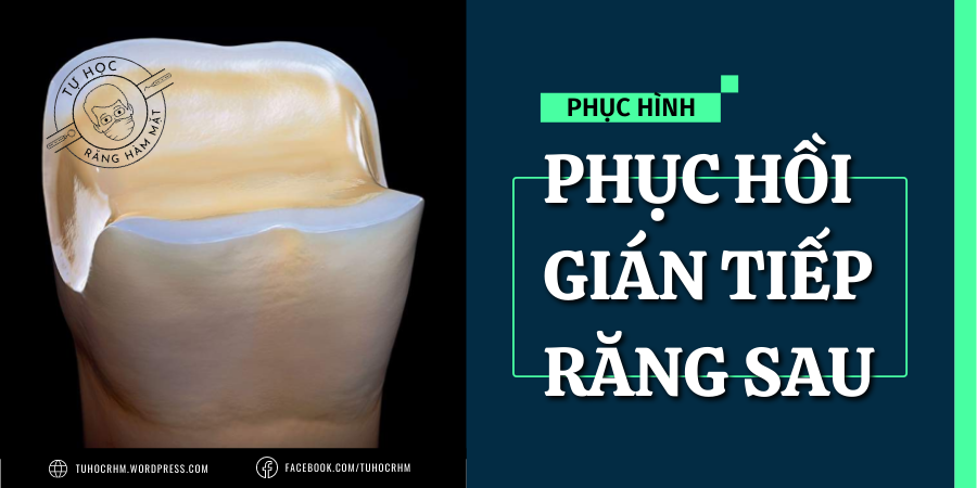 Kỹ Thuật Build-up & Thiết Kế Mài PIAR Răng Sau (P2)
