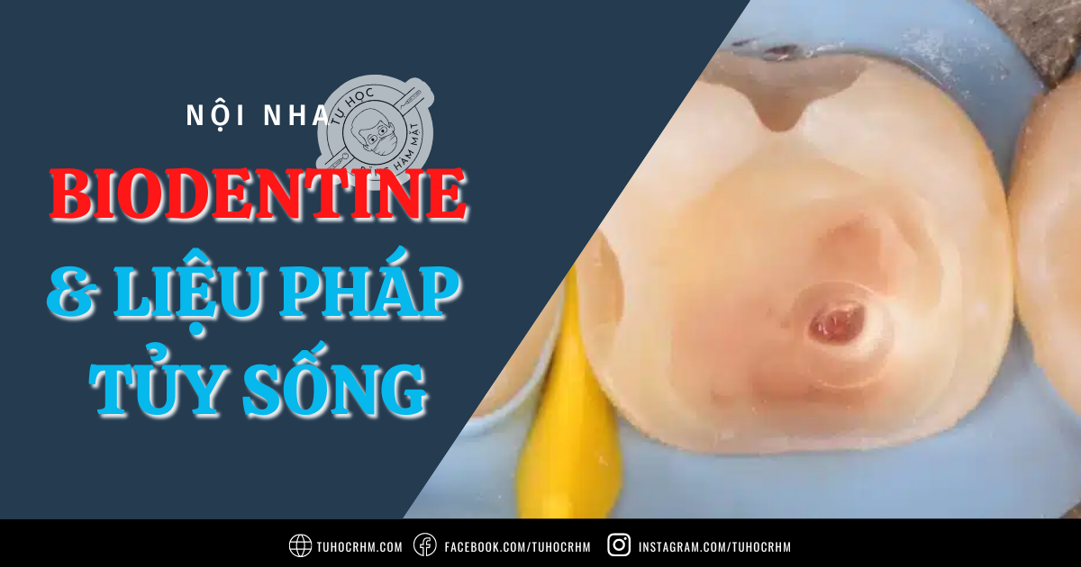 Biodentine & Liệu Pháp Tủy Sống Ở Răng Vĩnh Viễn (Cập Nhật 2026)