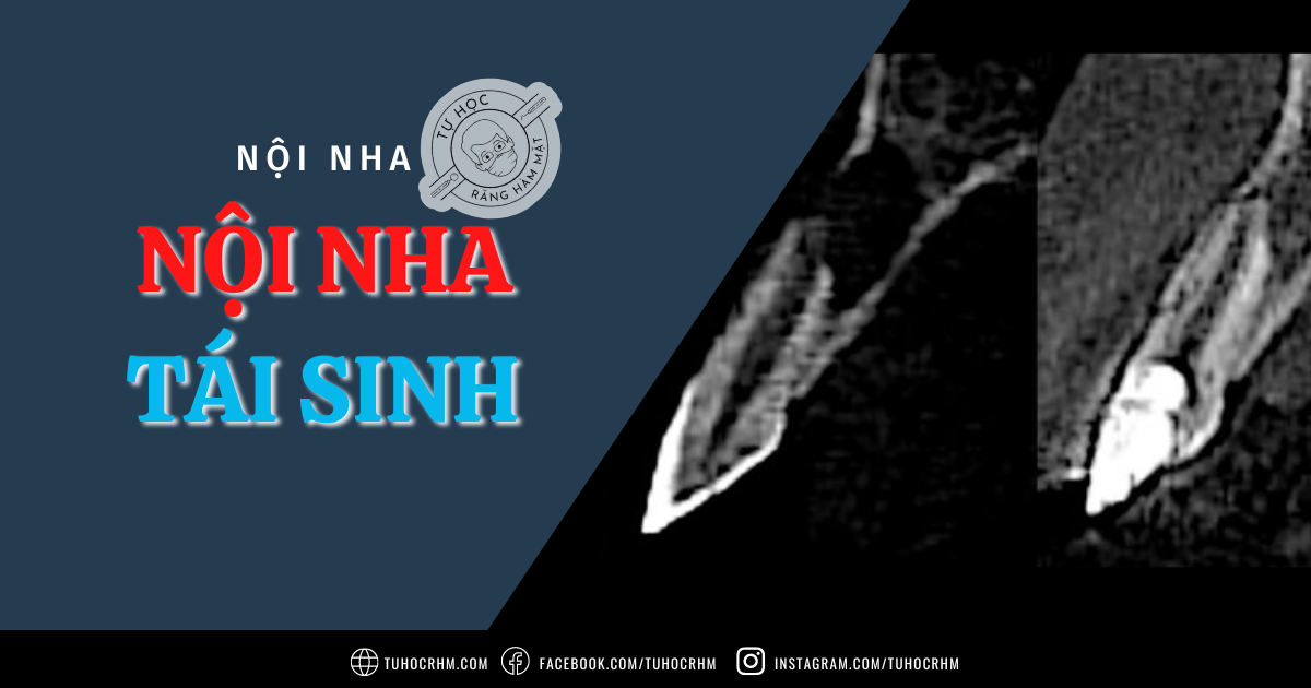 Nội Nha Tái Sinh/Tái Tạo: Kỹ Thuật & Cập Nhật Mới Nhất (2026)