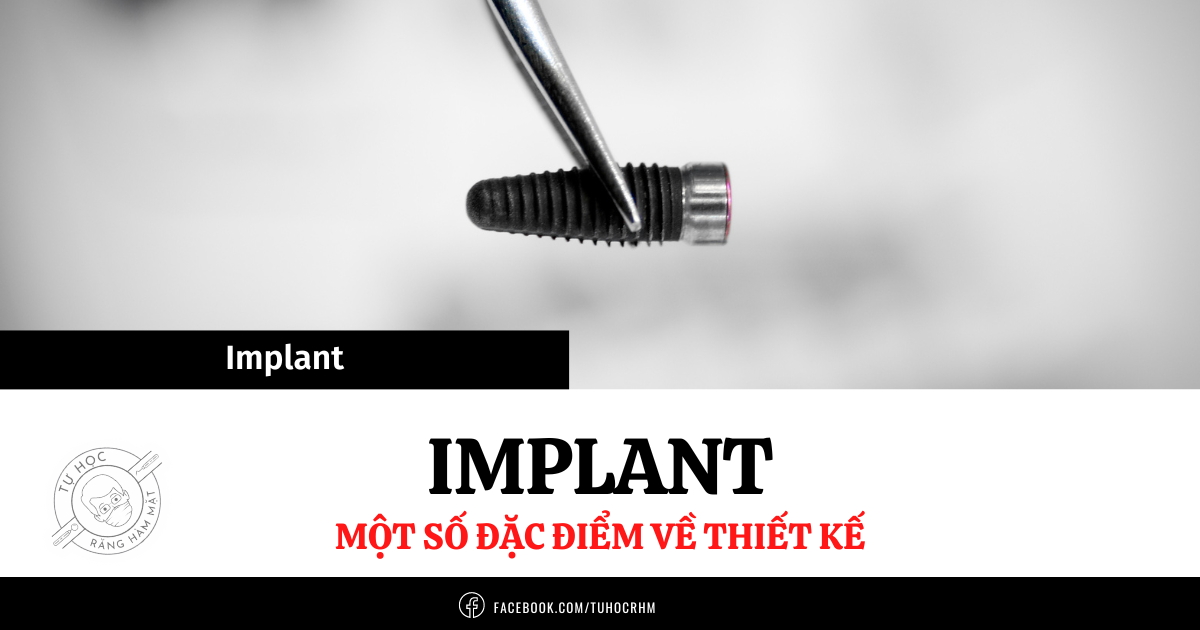 Đặc Điểm Của Implant Nha Khoa: Vật Liệu, Bề Mặt & Thiết Kế (2026)
