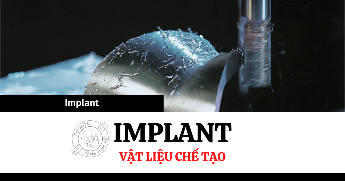 Vật Liệu Chế Tạo Implant Nha Khoa: Phân Loại & Đặc Điểm (2026)