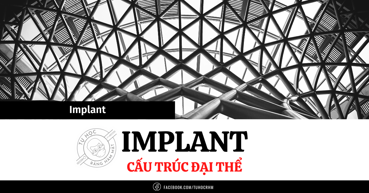Cấu Trúc Đại Thể Của Implant: Hình Dáng, Ren & Kết Nối (2026)
