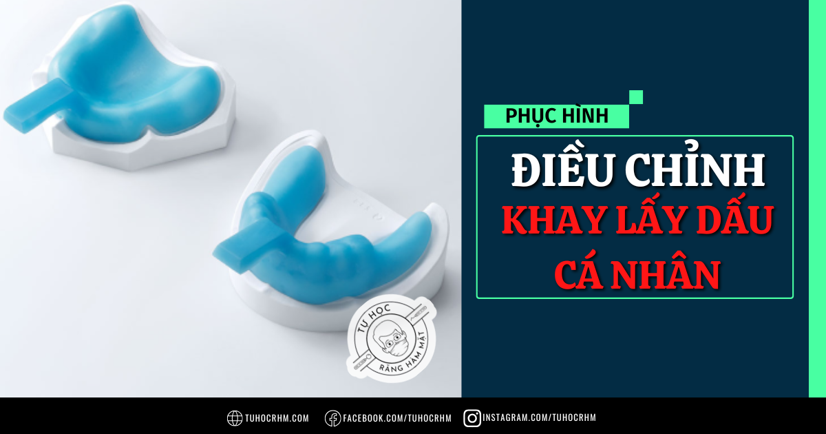 Hướng Dẫn Điều Chỉnh Khay Cá Nhân Trong Phục Hình Toàn Hàm (2026)