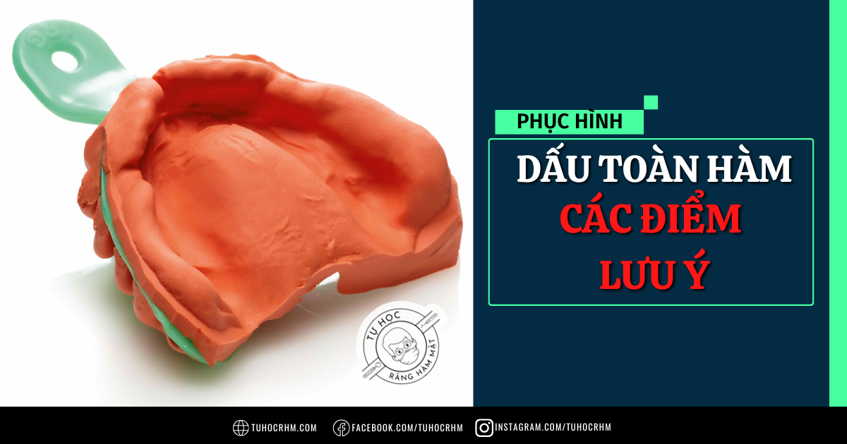 Dấu Toàn Hàm: 5 Nguyên Tắc Chẩn Đoán & Những Điểm Cần Lưu Ý (2026)