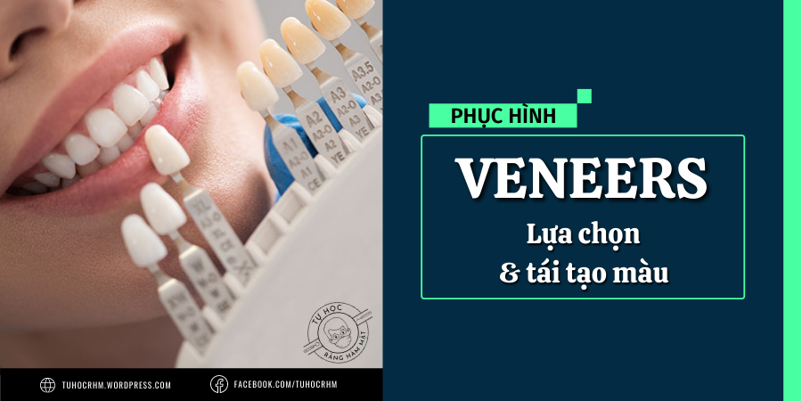 Veneer Sứ: Kỹ Thuật Lựa Chọn & Tái Tạo Màu Sắc Hoàn Hảo (2026)
