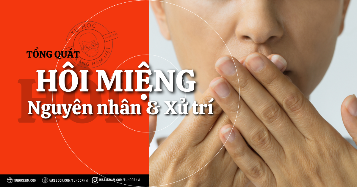 Hôi Miệng: Nguyên Nhân, Chẩn Đoán & Cách Điều Trị (2026)