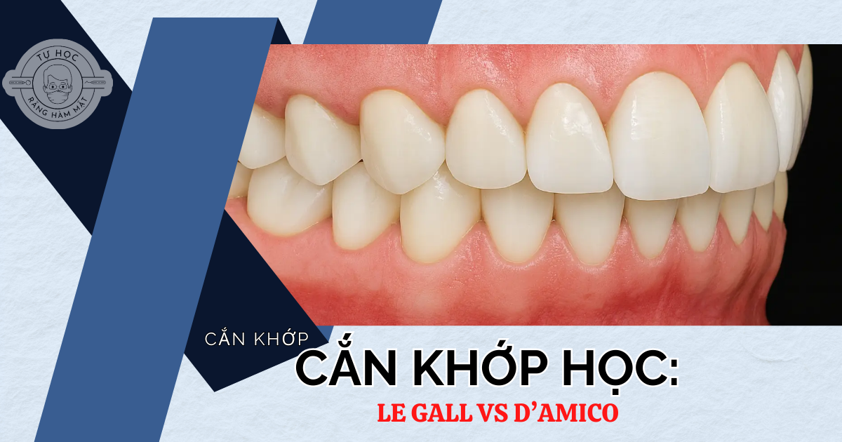 Khớp Cắn Le Gall vs d'Amico (P1): Sự Thật Về Răng Nanh (2026)