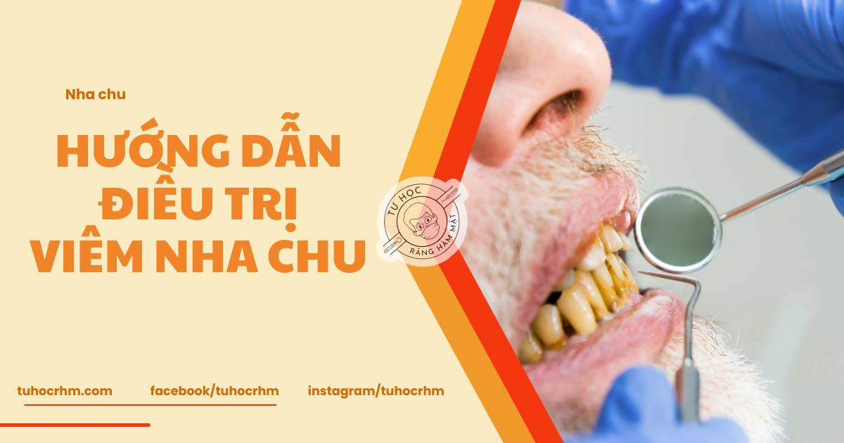 Guideline Điều Trị Viêm Nha Chu Giai Đoạn 1-3 (Theo EFP 2026)