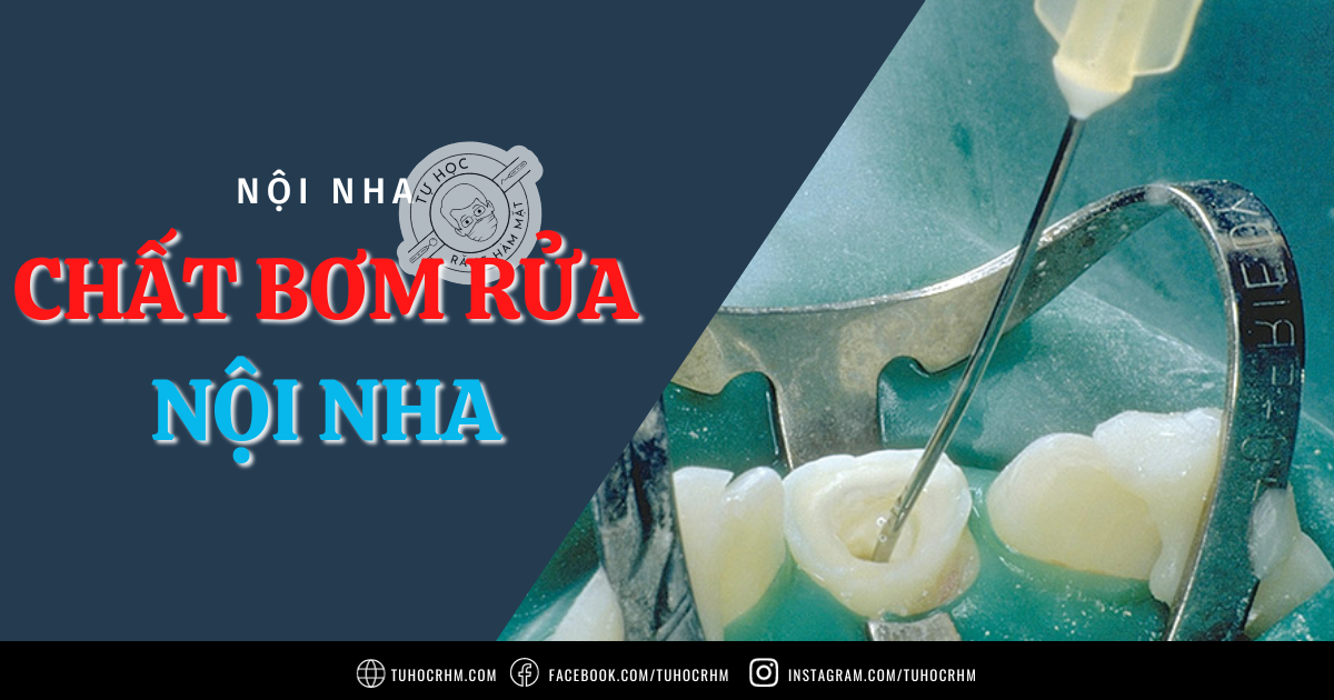 Chất Bơm Rửa Nội Nha (NaOCl, CHX, EDTA): Giao Thức Chuẩn (2026)