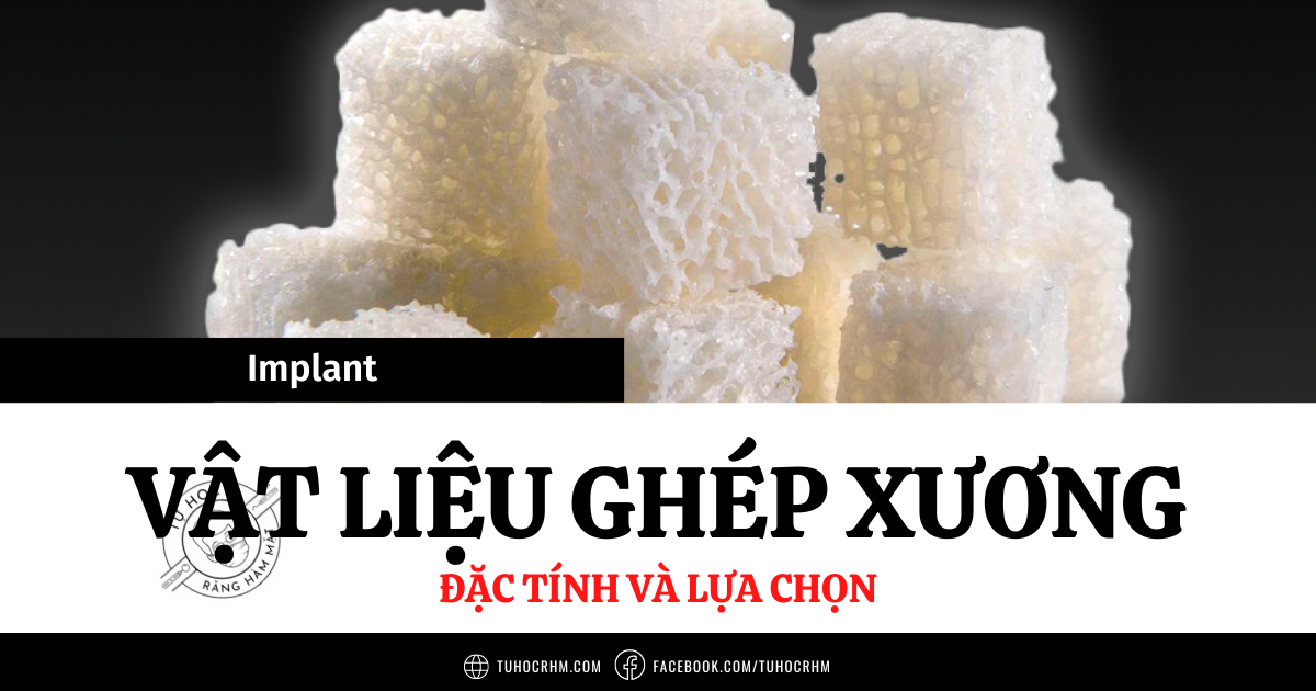 Đặc Tính Các Loại Vật Liệu Ghép Xương Trong Implant (2026)