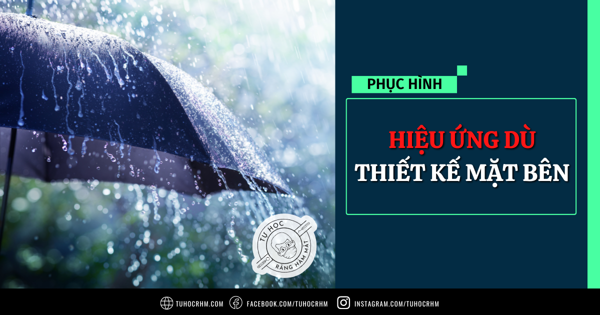 Hiệu Ứng Dù & Thiết Kế Mặt Bên Trong Phục Hình Cố Định (2026)