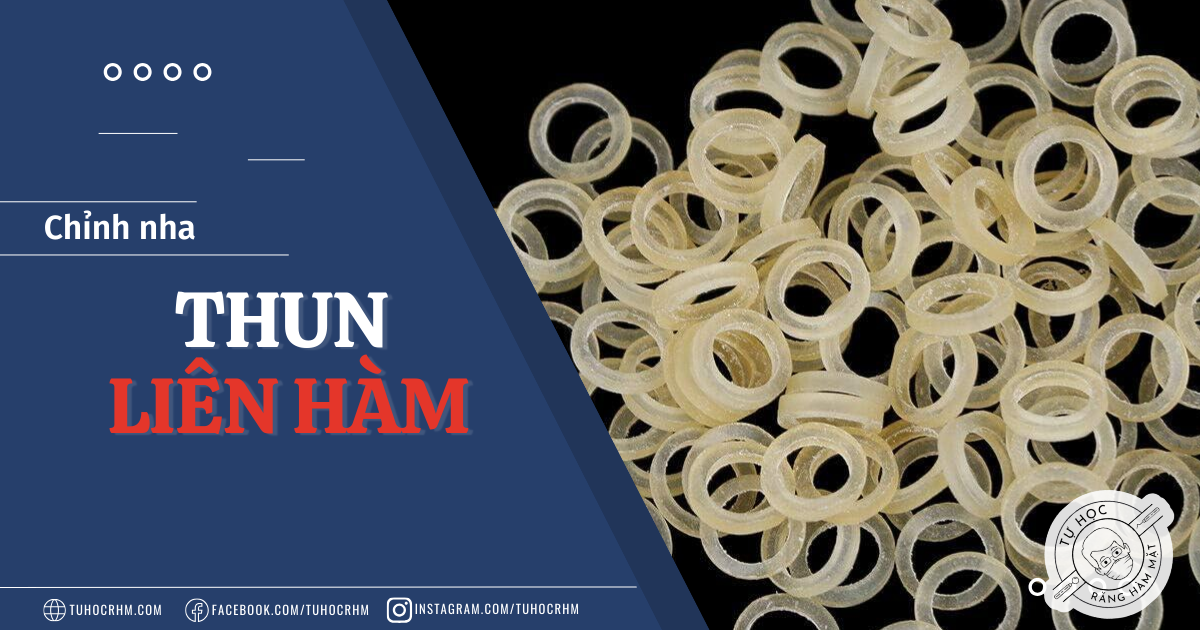 Thun Liên Hàm Chỉnh Nha: Cơ Sinh Học, Cách Móc & Tác Dụng Phụ (2026)
