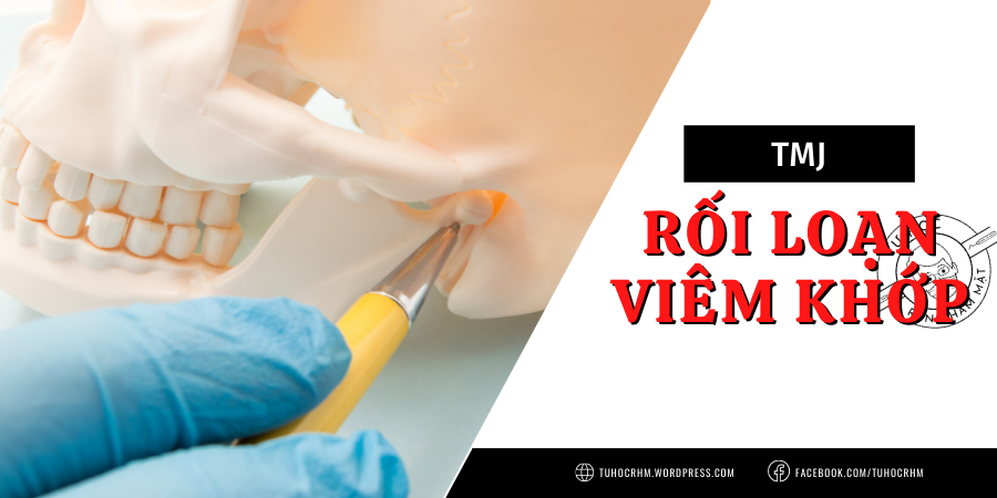 TMJ: Các Rối Loạn Viêm Tại Khớp & Viêm Mô Sau Đĩa (2026)