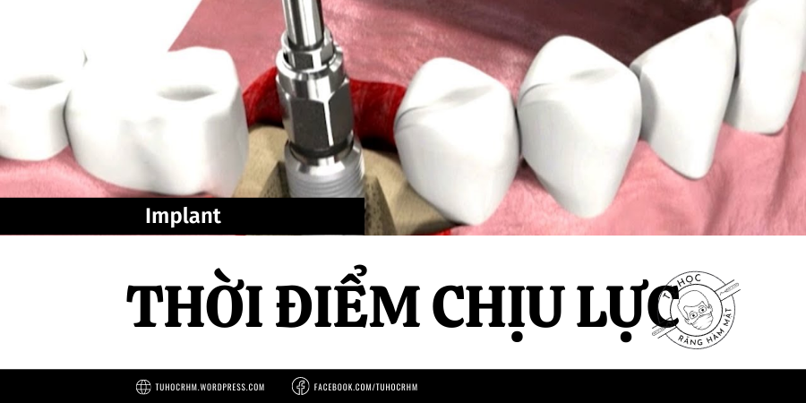 Thời Điểm Chịu Lực Của Implant: Giao Thức Tải Tức Thì & Trì Hoãn (2026)