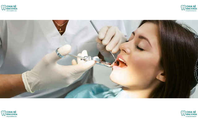 Có Cần Phải Lấy Cao Răng Thường Xuyên? Sự Thật Nha Khoa