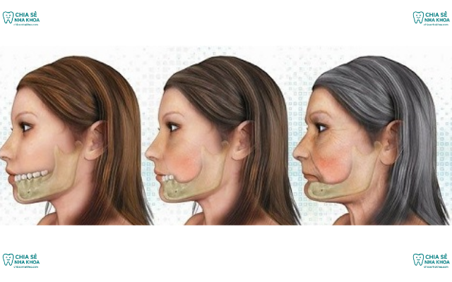Hậu Quả Mất Răng Và Phương Pháp Phục Hồi Hiệu Quả Nhất
