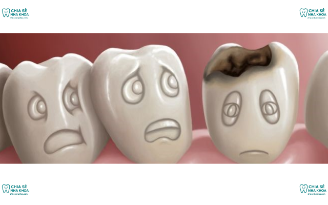 Răng Yếu Dần Do Không Đánh Răng Trước Khi Đi Ngủ và Cách Sửa
