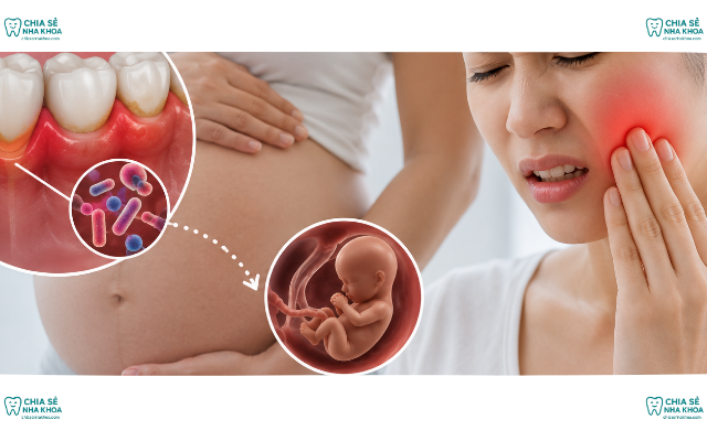 Bệnh Nha Chu Và Nguy Cơ Sinh Non: Mối Liên Hệ Mẹ Bầu Cần Biết