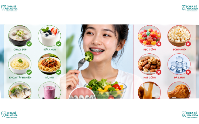 Cẩm Nang Chăm Sóc Ăn Uống Khi Niềng Răng: Hướng Dẫn An Toàn (2026)
