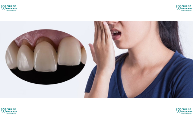 Dán Sứ Veneer Có Bị Hôi Miệng Không? Cách Phòng Ngừa (2026)
