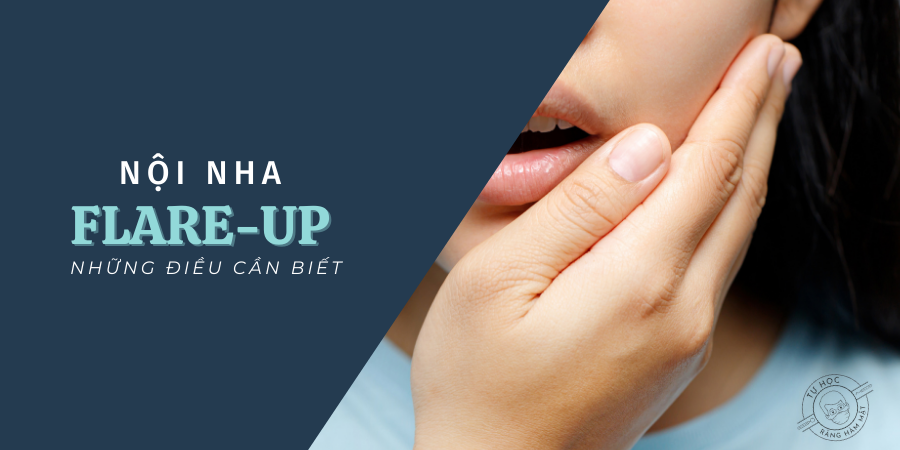 Flare-up nội nha: Nguyên nhân, Tỷ lệ và Cách xử trí cấp cứu