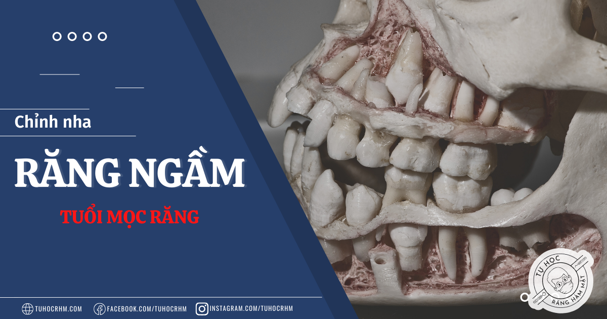 Đánh Giá Tuổi Mọc Răng: Tiêu Chuẩn Và Phương Pháp Chẩn Đoán (2026)