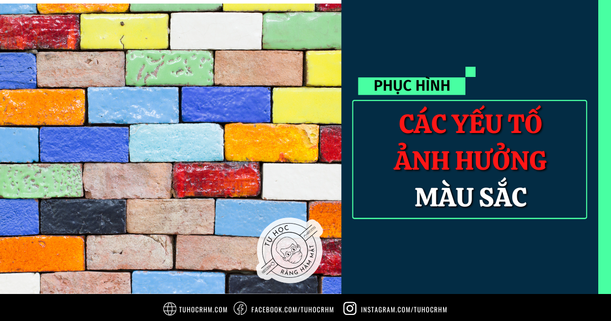 Hướng Dẫn Lựa Chọn Abutment Implant: Custom, Stock Hay Chuyển Góc?