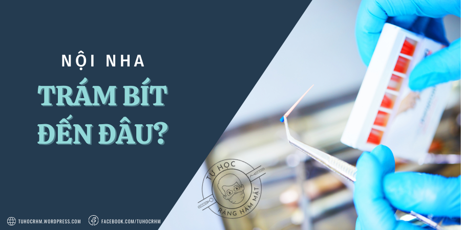 Giới hạn trám bít ống tủy: CDJ, Chóp trên phim hay Chóp điện?