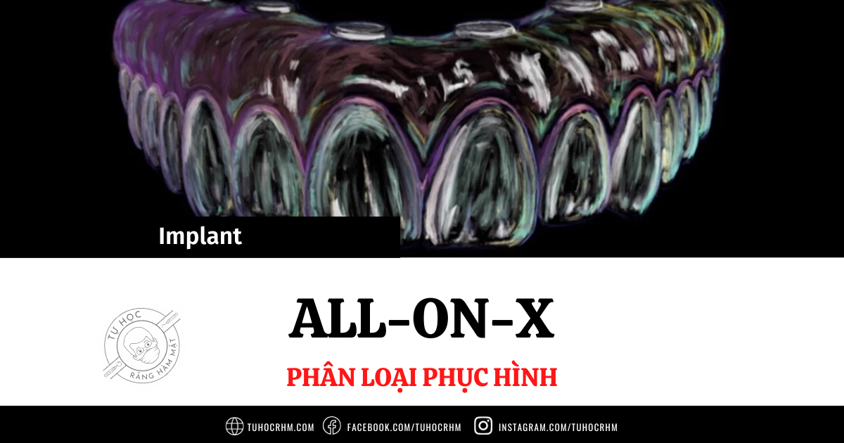 Bioceramic, MTA, Calcium Silicate Trong Nội Nha Là Gì? (2026)