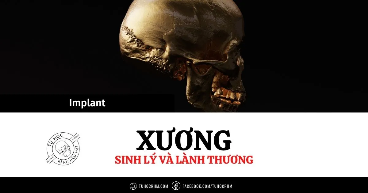 Sinh Lý Và Cơ Chế Lành Thương Xương Quanh Implant (2026)