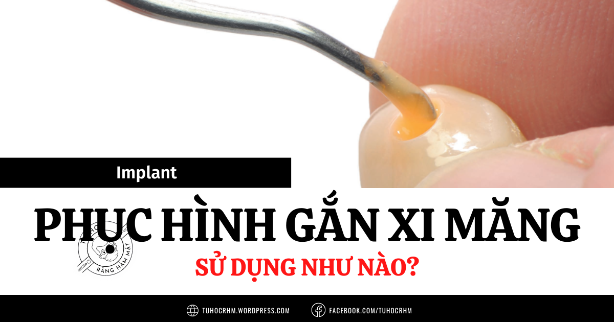 Implant Phục Hình Gắn Xi Măng: Rủi Ro Viêm Quanh Implant Do Xi Măng Dư