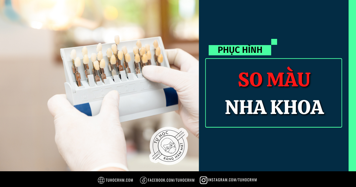 So Màu Nha Khoa: Các Hệ Thống Bảng Màu & Quy Trình Chuẩn (2026)