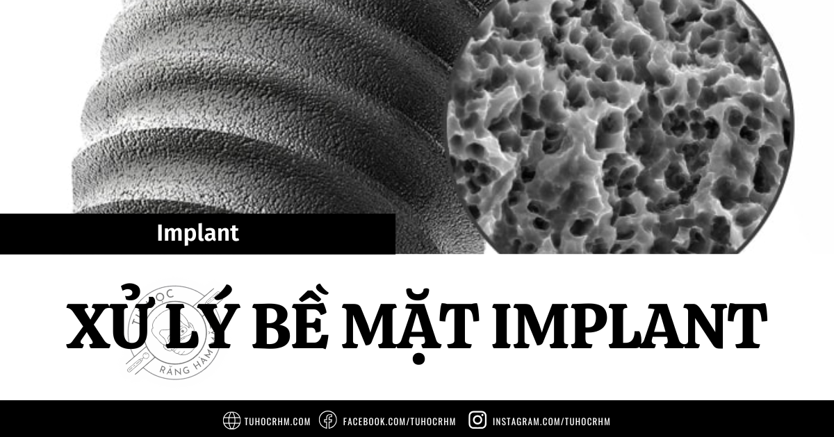 Tổng Quan Các Phương Pháp Xử Lý Bề Mặt Implant Mới Nhất (2026)