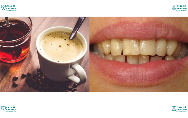 Uống Cà Phê Có Làm Răng Xỉn Màu, Hôi Miệng? | Giải Đáp Từ Bác Sĩ Nha Khoa 2026