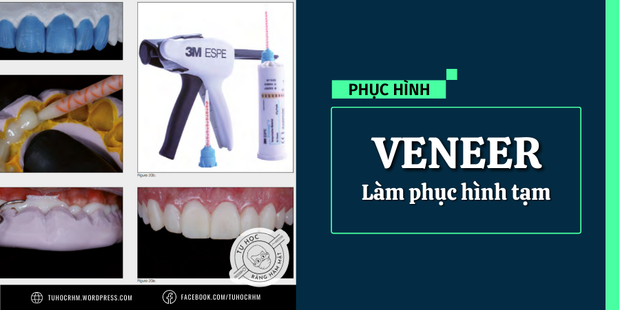 Hướng Dẫn Kỹ Thuật Làm Phục Hình Tạm Cho Veneer Sứ (2026)