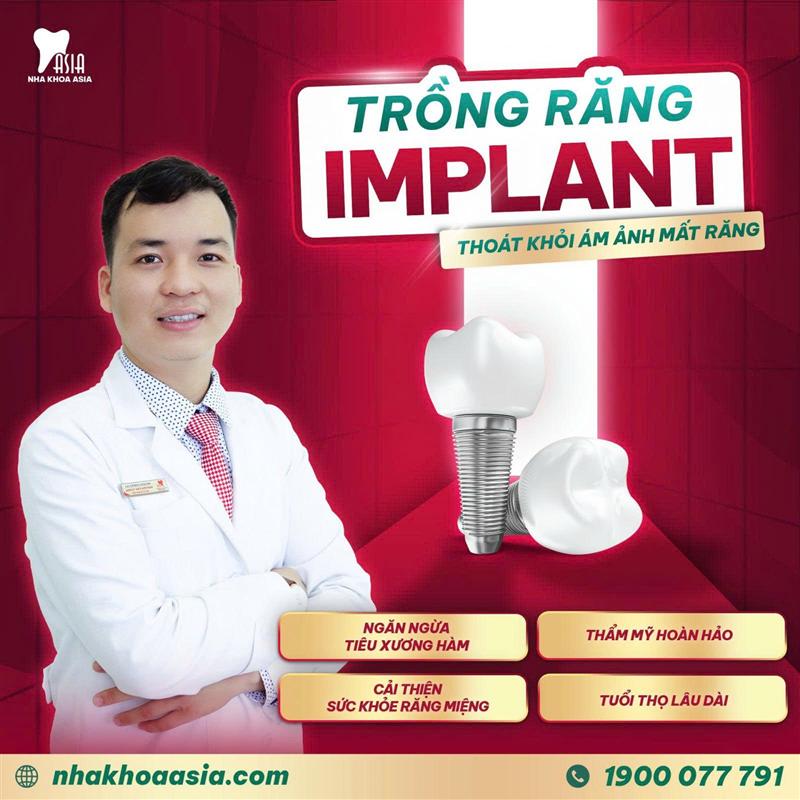 Cấy Ghép Implant Giá 2026 Mới Nhất Quy Trình 7 Bước - Bảo Hành Trọn Đời