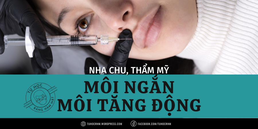 Điều trị cười hở nướu do môi: Phẫu thuật tái định vị và Tiêm Botox