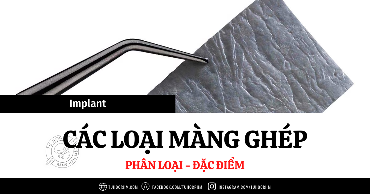 Các Loại Màng Ghép Trong GBR: Tiêu & Không Tiêu (2026)