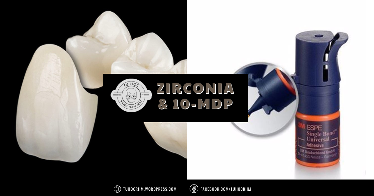 Xi Măng Resin & Phân Tử 10-MDP: Tiêu Chuẩn Vàng Gắn Sứ Zirconia (2026)